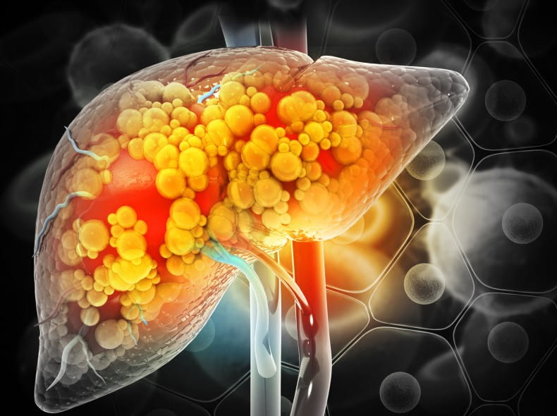 Liver pathology