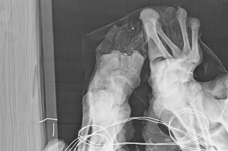 An X-ray of the mummy’s feet.