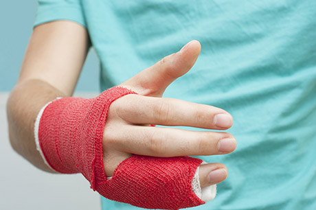 child arm in cast