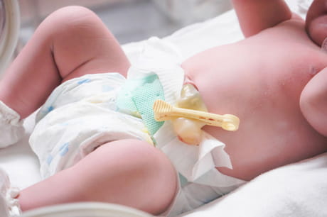 Newborn baby with umbilical cord cut off point