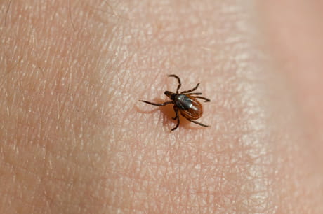 A tick on the skin.