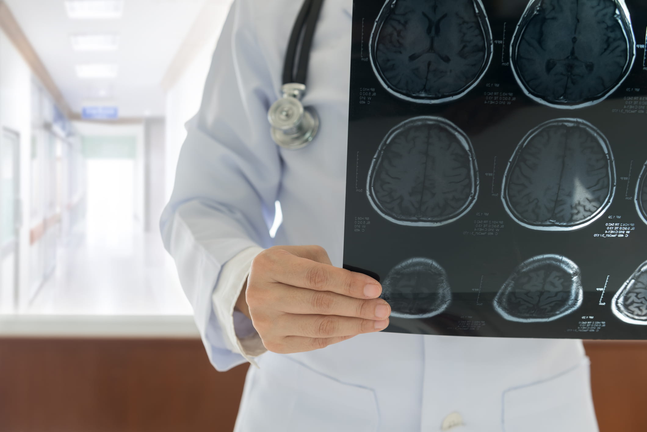 Doctor wearing white coat examines brain images on an X-ray