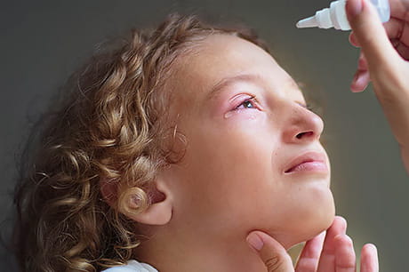 A young patient with conjunctivitis (pink eye) has a eye drops applied to alleviate discomfort.