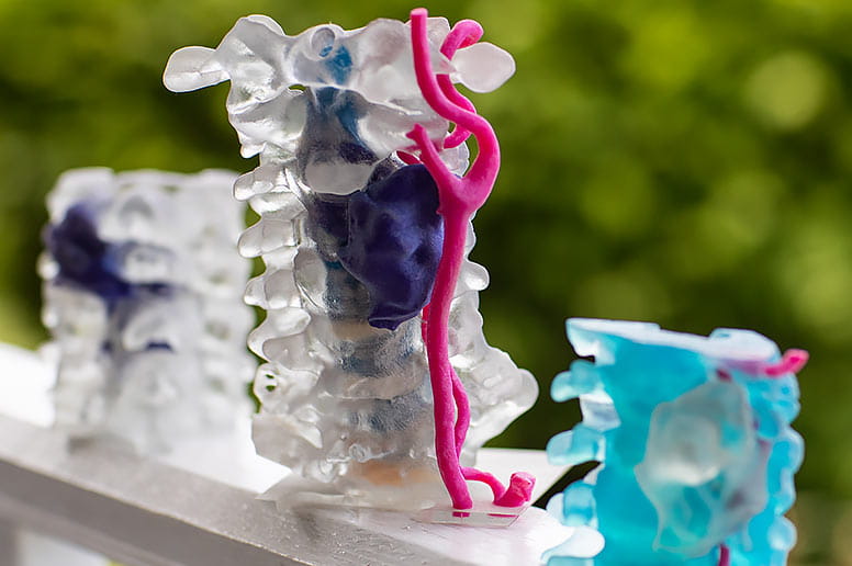 3D models of Frank Ditaranto's spine.