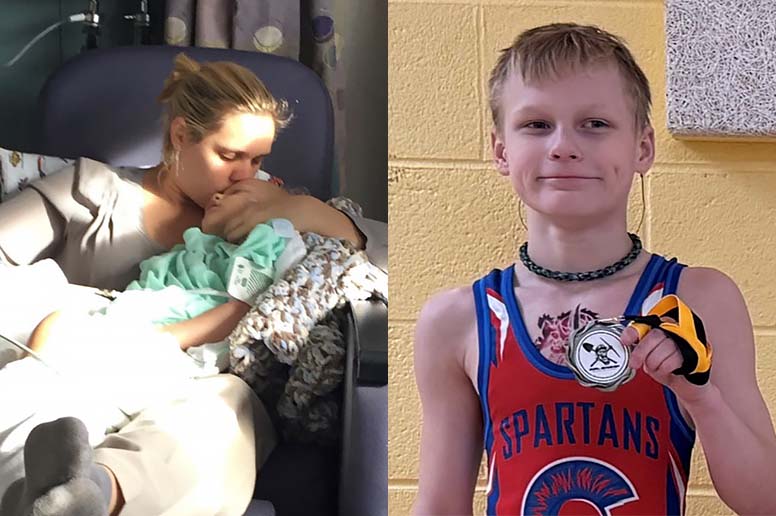 A young Miracle Kid patient is pictured in contrasting stages of life.