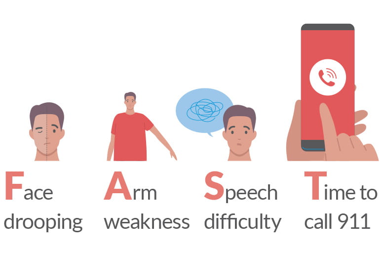Stroke awareness infographic showing FAST warning signs including face drooping, arm weakness, speech difficulty, and time to call 911.