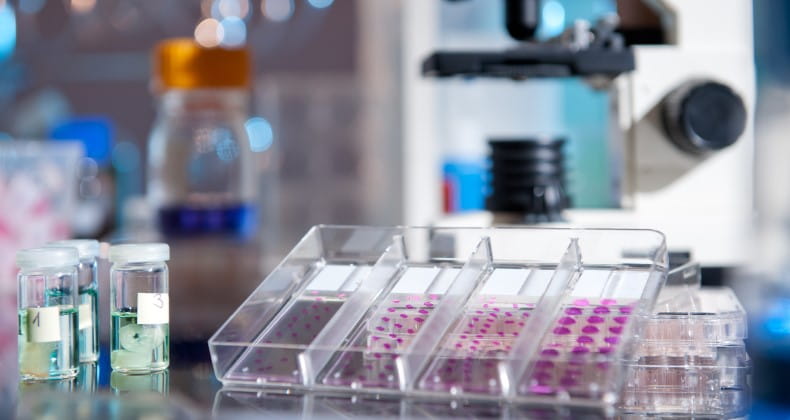 Plastic tray of histological tissue samples next to a microscope