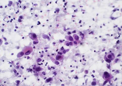 cytology_clip_image002